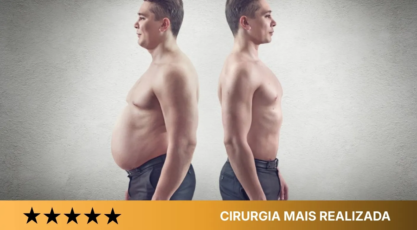 Dra. Camila - Cirurgias mais buscadas e atendidas - Cirurgia bariátrica