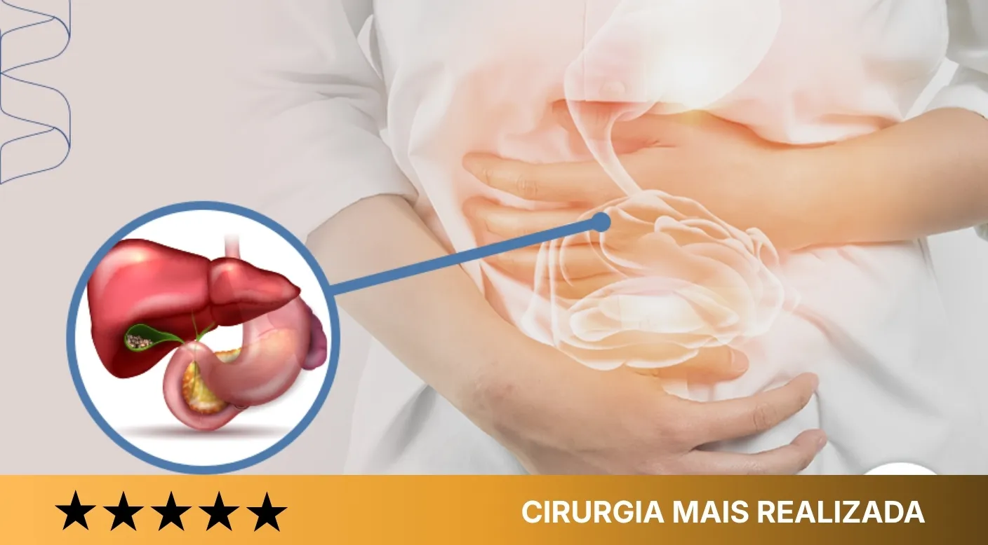 Dra. Camila - Cirurgias mais buscadas e atendidas-Pedra na vesícula