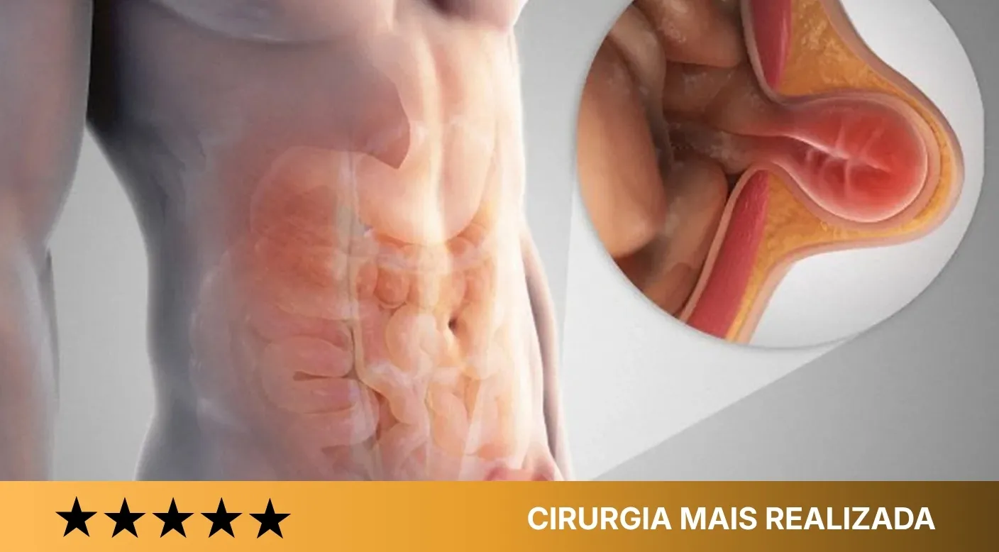 Dra. Camila - Cirurgias mais buscadas e atendidas-Hérnia (inguinal, incisional, ventral, epigástrica)